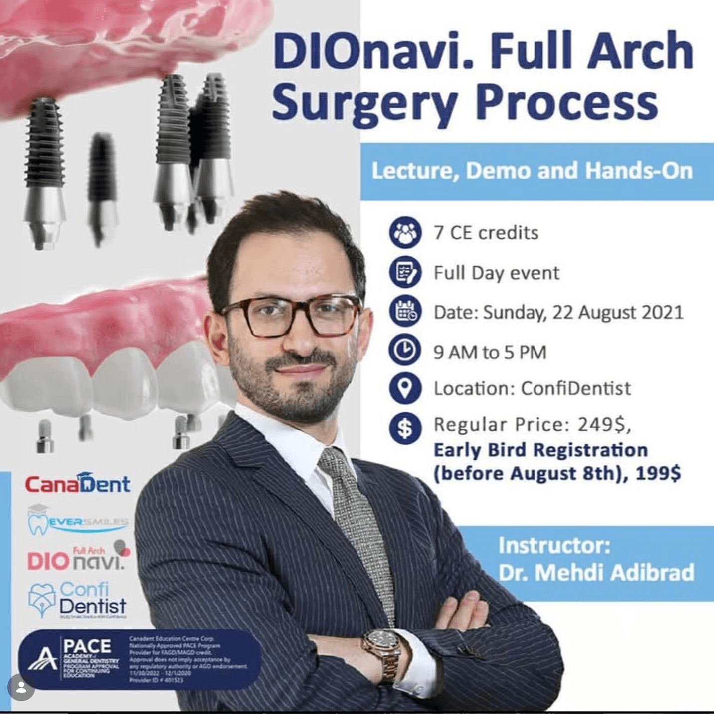 DIONavi. Full Arch Surgery Process