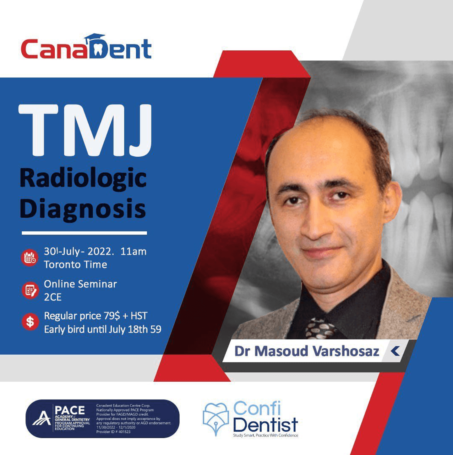 TMJ Radiologic Diagnosis